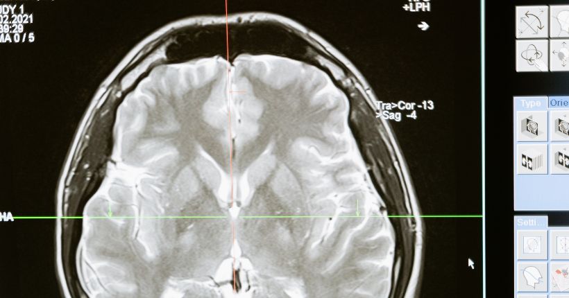 Semana Mundial del Cerebro 2023